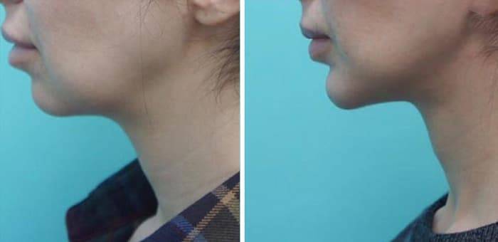 Топ-10 бюджетных идей для дома, которые делают его максимально комфортным