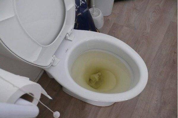 Что делать, если не уходит вода в унитазе и в ванной в квартире или частном доме