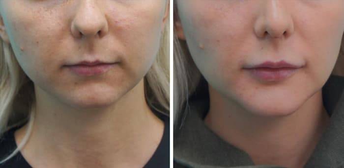 Топ-10 бюджетных идей для дома, которые делают его максимально комфортным