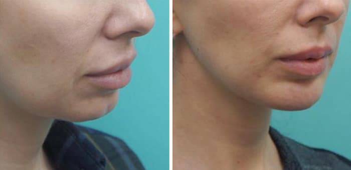 Топ-10 бюджетных идей для дома, которые делают его максимально комфортным