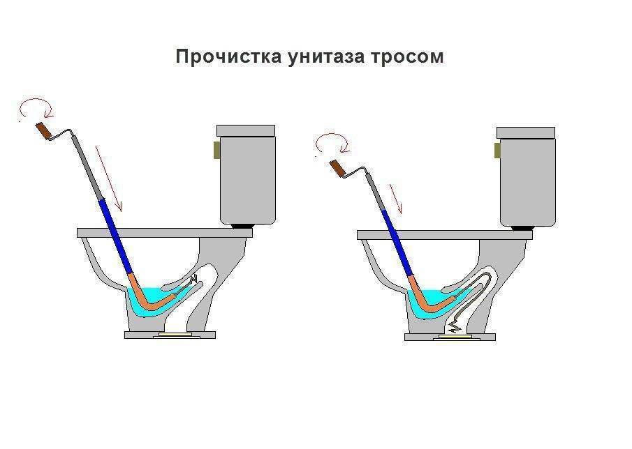 Вода в унитазе поднимается: видео-инструкция как остановить своими руками, что делать, если упал уровень, жидкость переливается, стоит, булькает, выбивается воздухом, стала закручиваться вверх, как ос